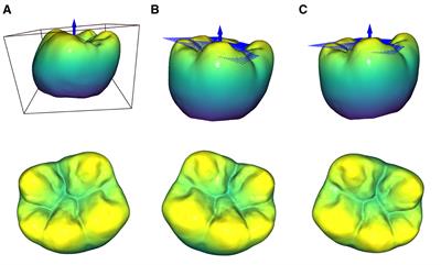 A data-driven approach for the partial reconstruction of individual human molar teeth using generative deep learning